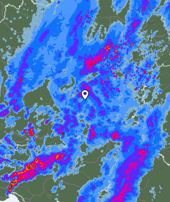 Radar