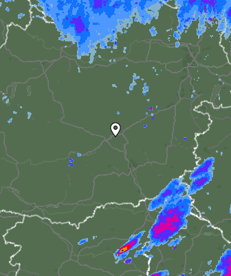Radar