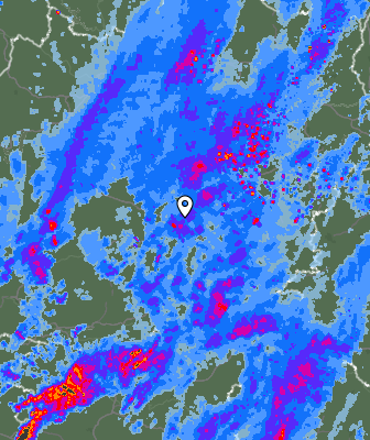 Radar
