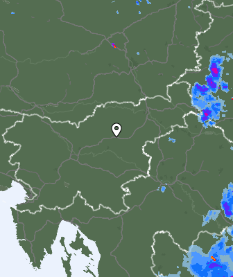Radar