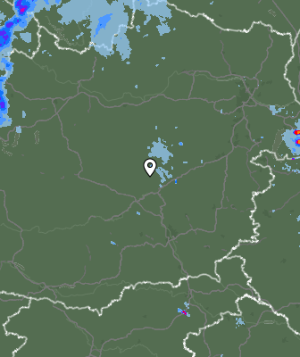 Radar