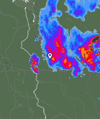 Radar