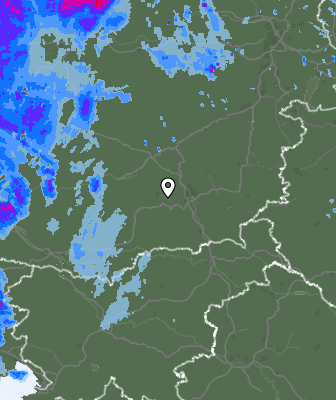 Radar
