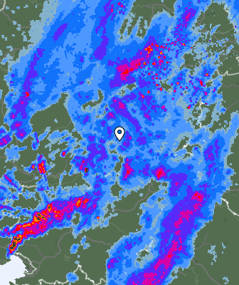 Radar