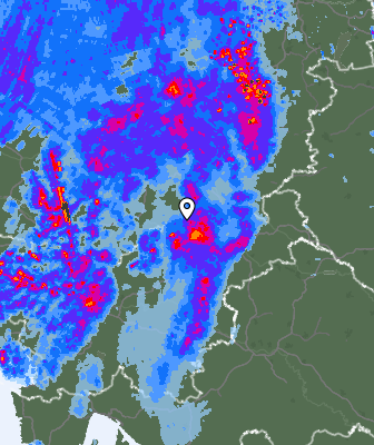 Radar