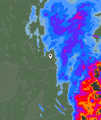Radar