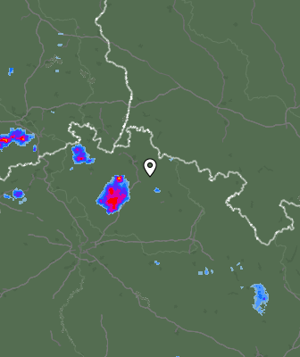Radar
