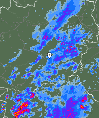 Radar