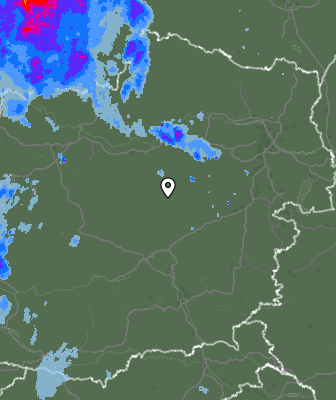 Radar
