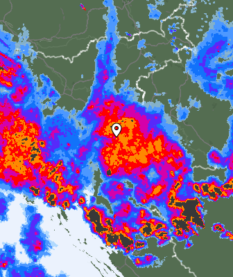 Radar