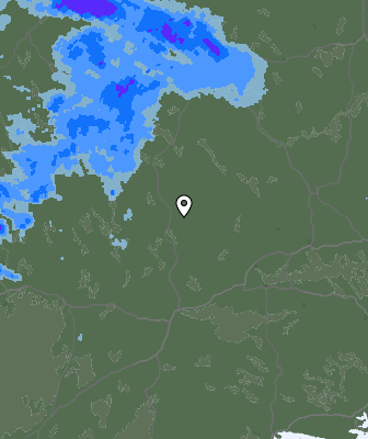 Radar