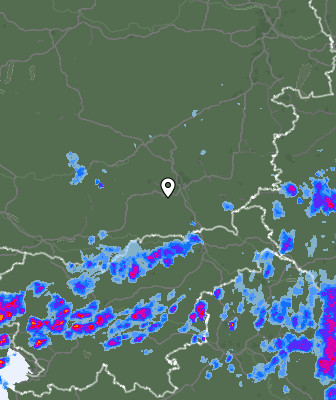 Radar