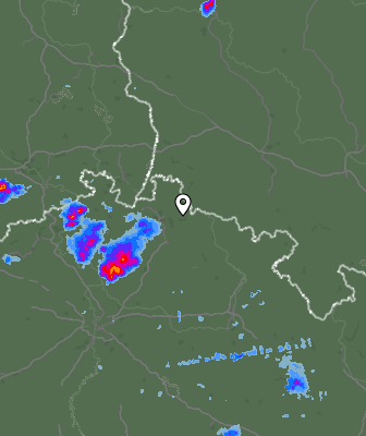 Radar