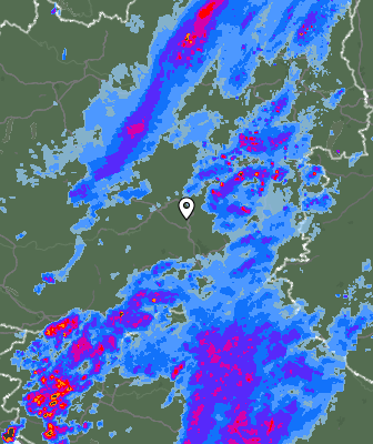 Radar