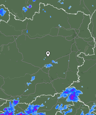 Radar