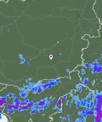 Radar