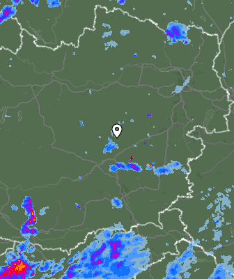 Radar