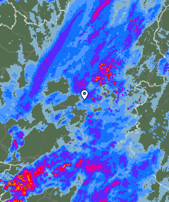 Radar