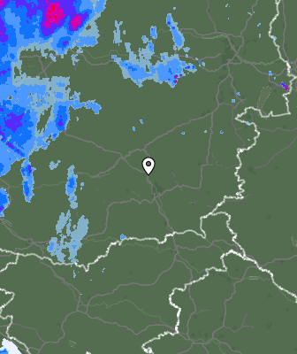 Radar