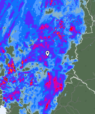 Radar