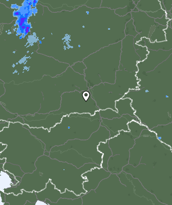 Radar