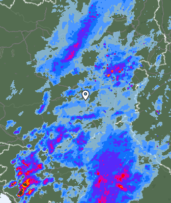Radar