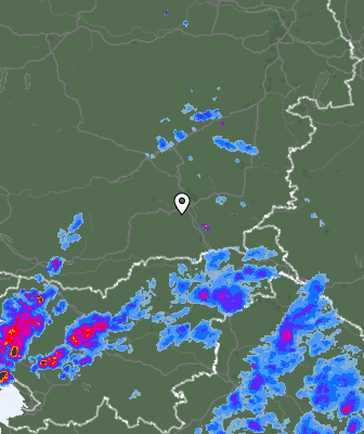 Radar