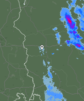 Radar