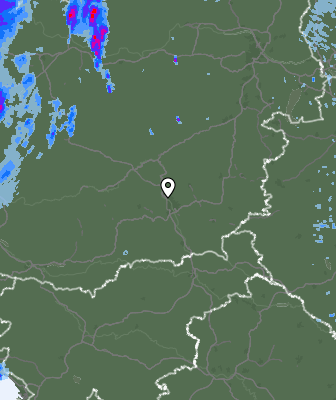 Radar