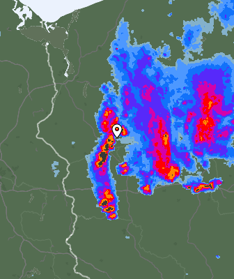Radar