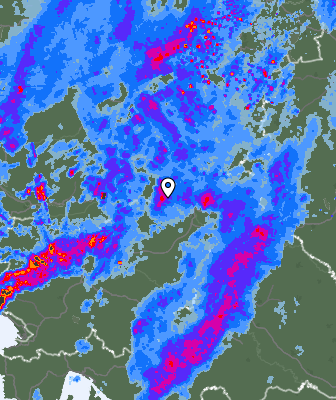 Radar