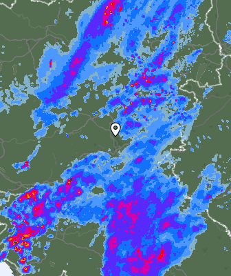 Radar