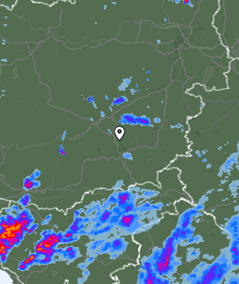 Radar