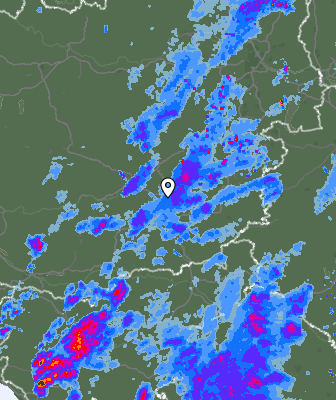 Radar