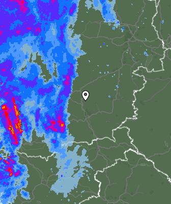 Radar