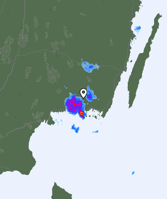 Radar