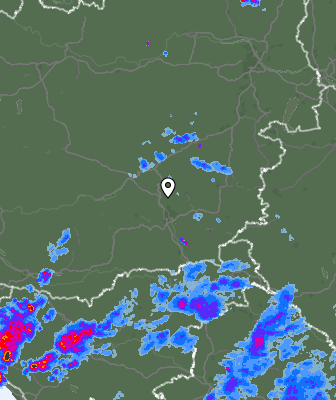 Radar