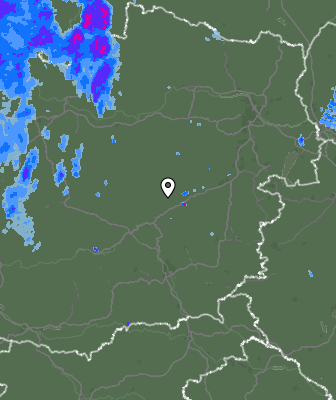 Radar
