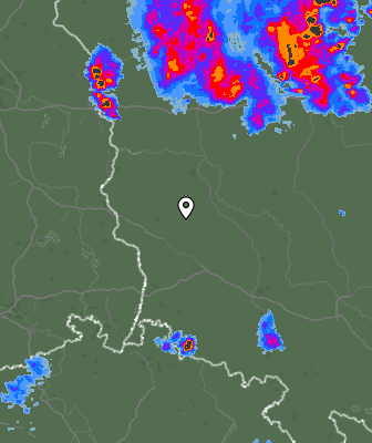 Radar
