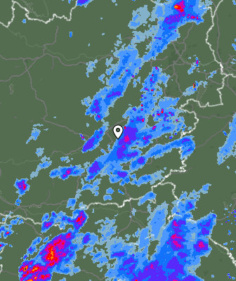 Radar