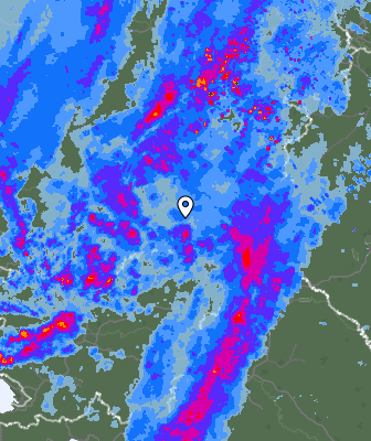 Radar