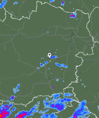 Radar