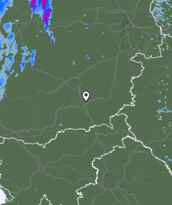 Radar