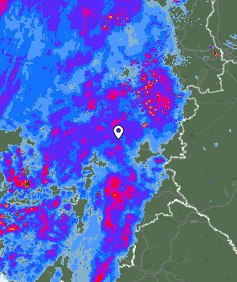 Radar
