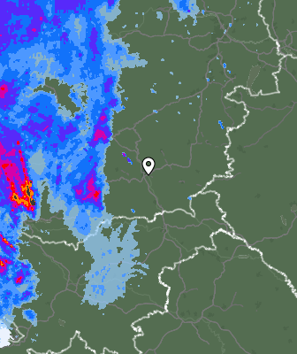 Radar