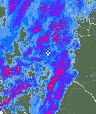 Radar