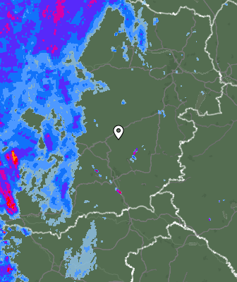 Radar