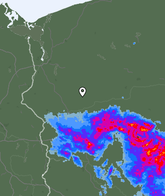 Radar