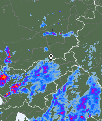Radar