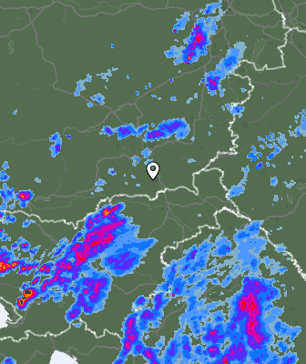 Radar